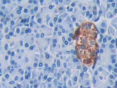 Monoclonal Antibody to Cathelicidin Antimicrobial Peptide (CAMP)