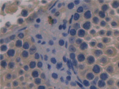 Monoclonal Antibody to Fibulin 1 (FBLN1)