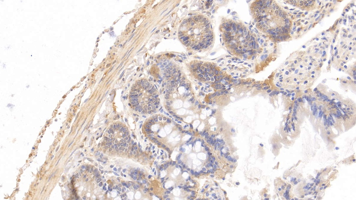 Monoclonal Antibody to Histidine Rich Glycoprotein (HRG)