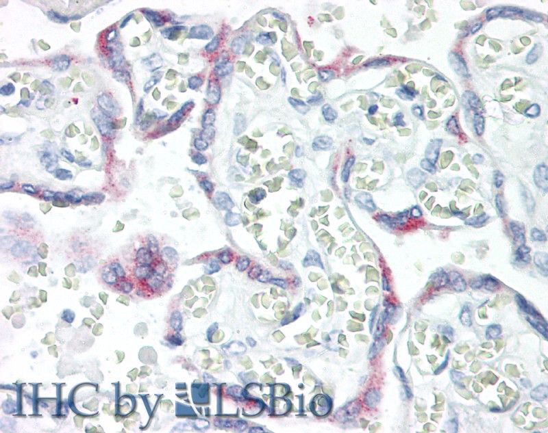 Monoclonal Antibody to Kisspeptin 1 (KISS1)