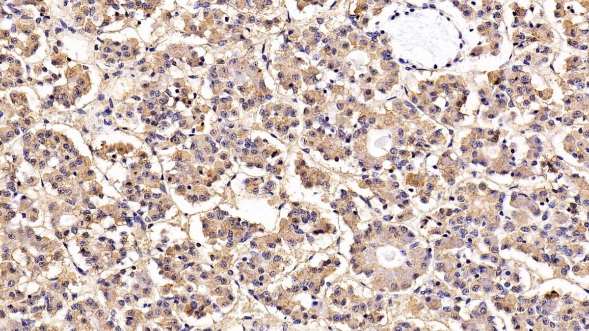 Monoclonal Antibody to Luteinizing Hormone Beta Polypeptide (LHb)