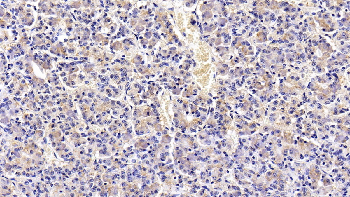 Monoclonal Antibody to Luteinizing Hormone Beta Polypeptide (LHb)