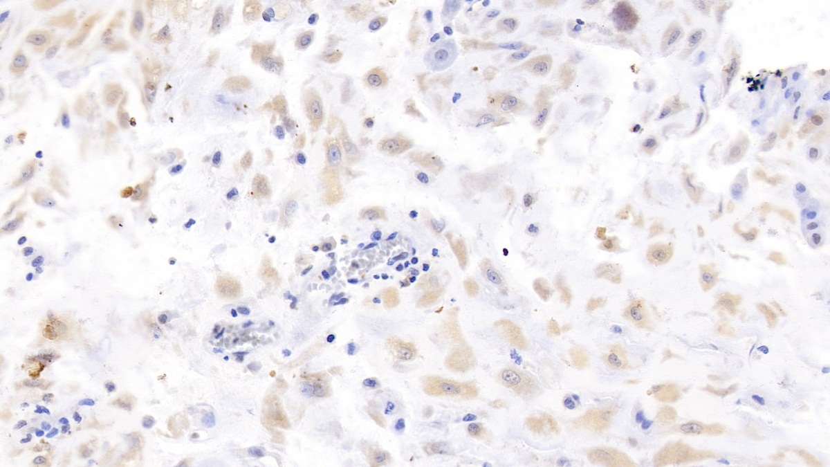 Monoclonal Antibody to Luteinizing Hormone Beta Polypeptide (LHb)