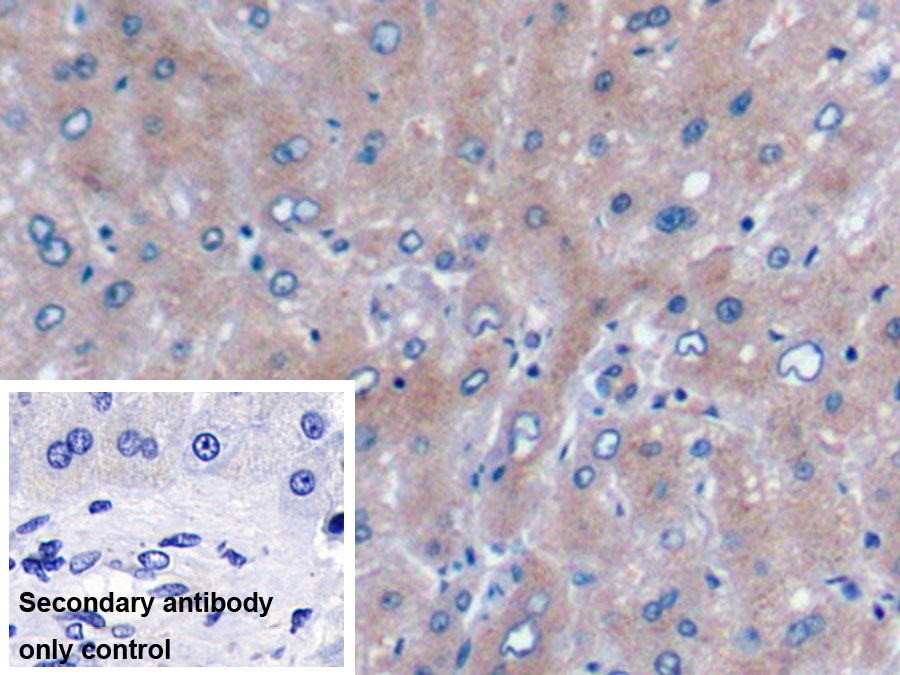 Monoclonal Antibody to Urocortin 2 (UCN2)