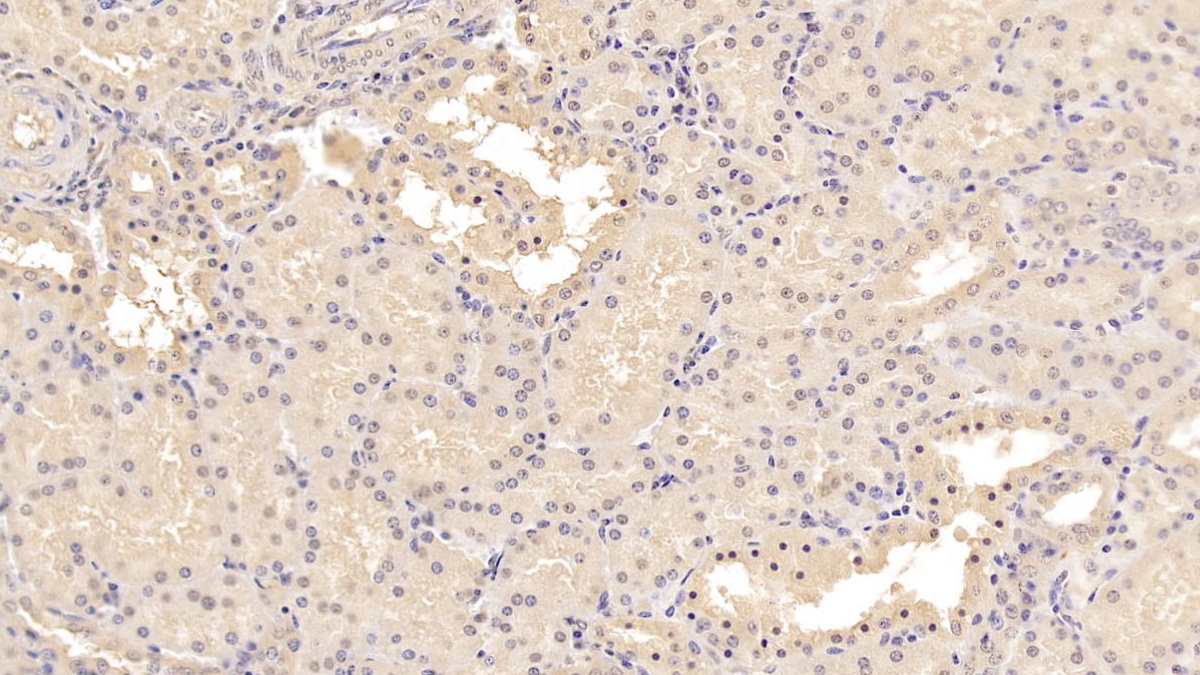 Monoclonal Antibody to Methionine Sulfoxide Reductase A (MSRA)