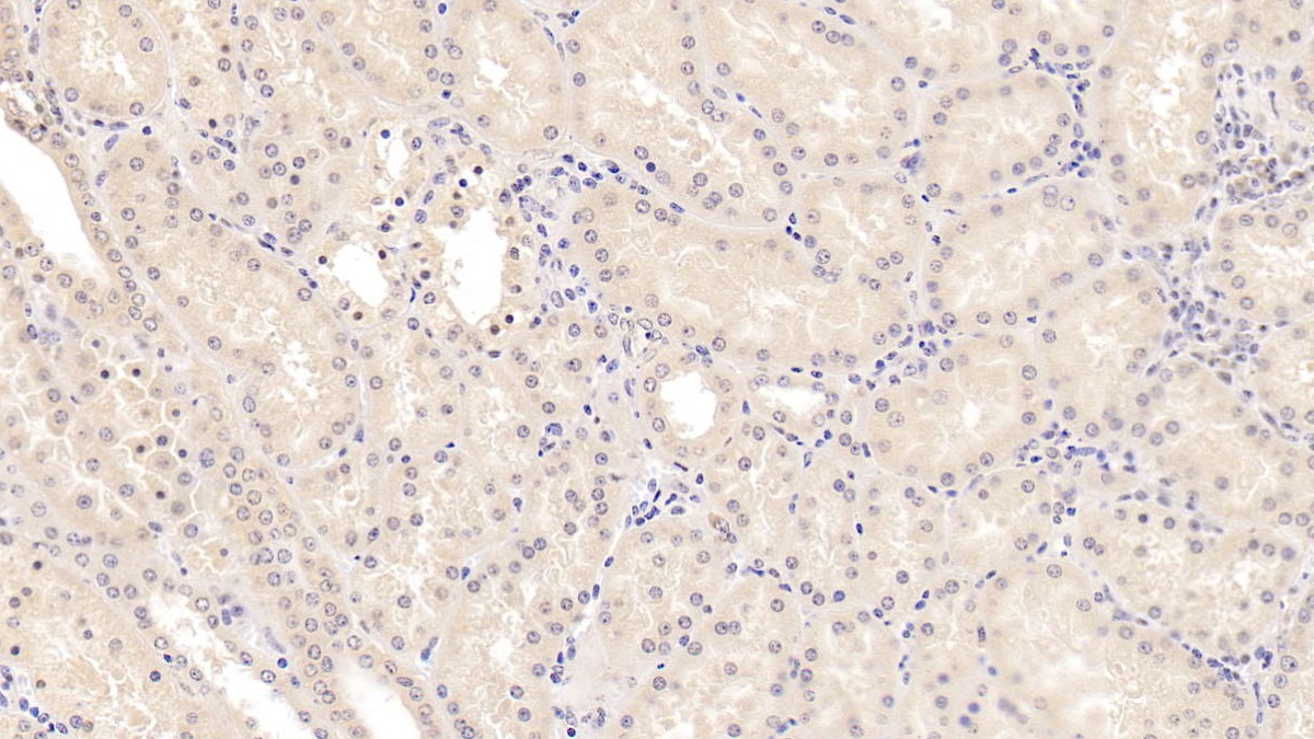 Monoclonal Antibody to Methionine Sulfoxide Reductase A (MSRA)