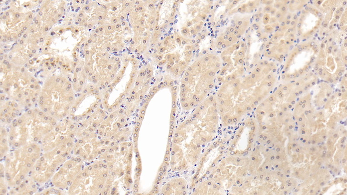 Monoclonal Antibody to Methionine Sulfoxide Reductase A (MSRA)