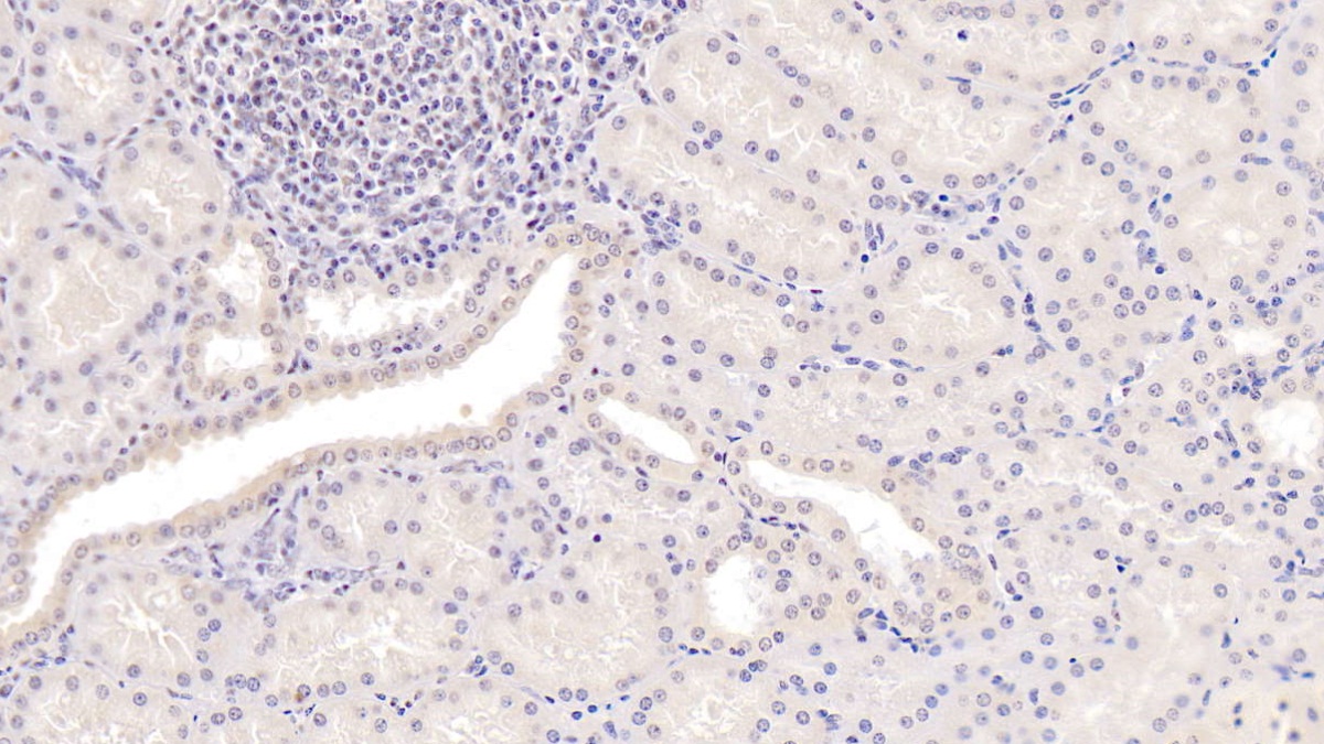 Monoclonal Antibody to Methionine Sulfoxide Reductase A (MSRA)