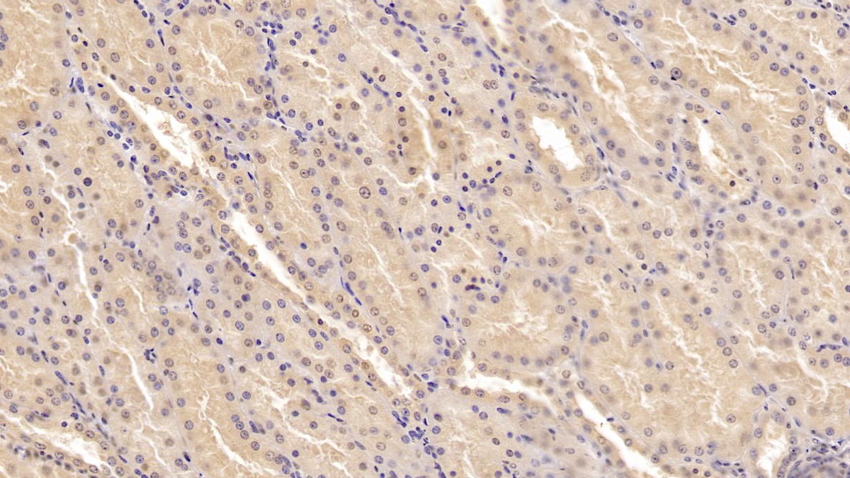 Monoclonal Antibody to Methionine Sulfoxide Reductase A (MSRA)