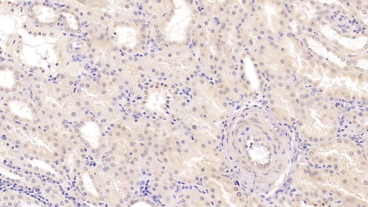 Monoclonal Antibody to Methionine Sulfoxide Reductase A (MSRA)