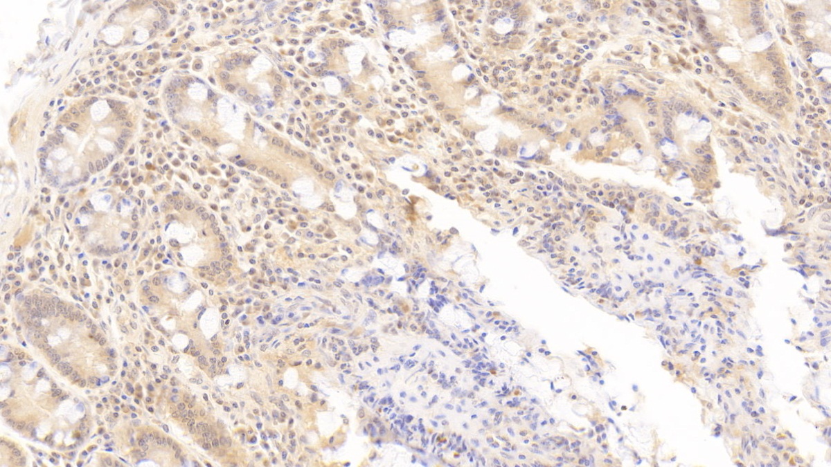 Monoclonal Antibody to 2',5'-Oligoadenylate Synthetase 1 (OAS1)