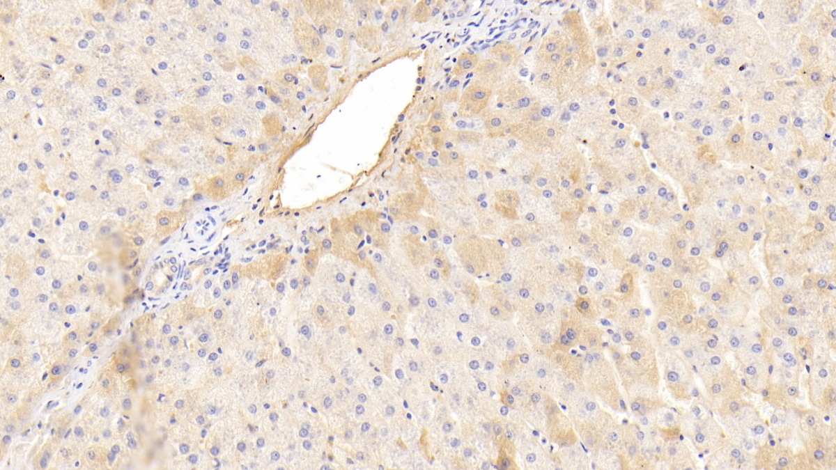 Monoclonal Antibody to Phenylalanine Hydroxylase (PAH)