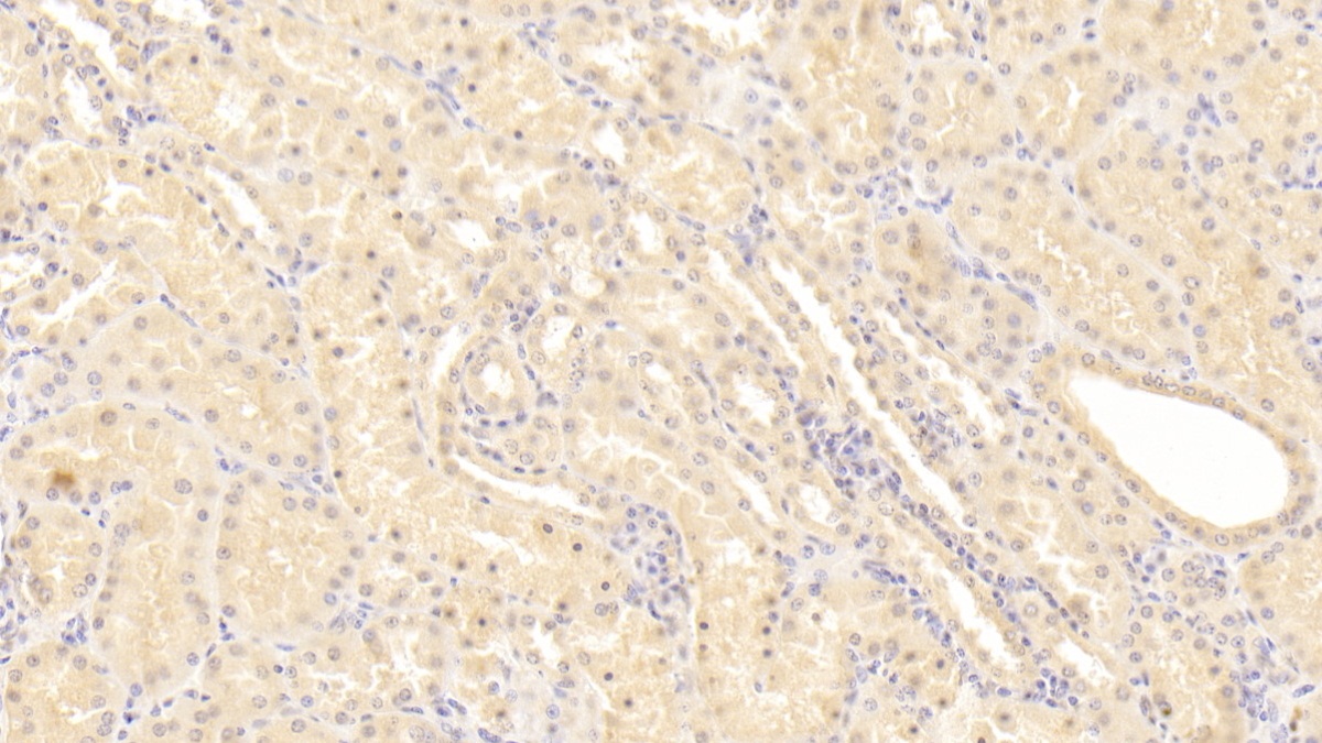 Monoclonal Antibody to Phenylalanine Hydroxylase (PAH)