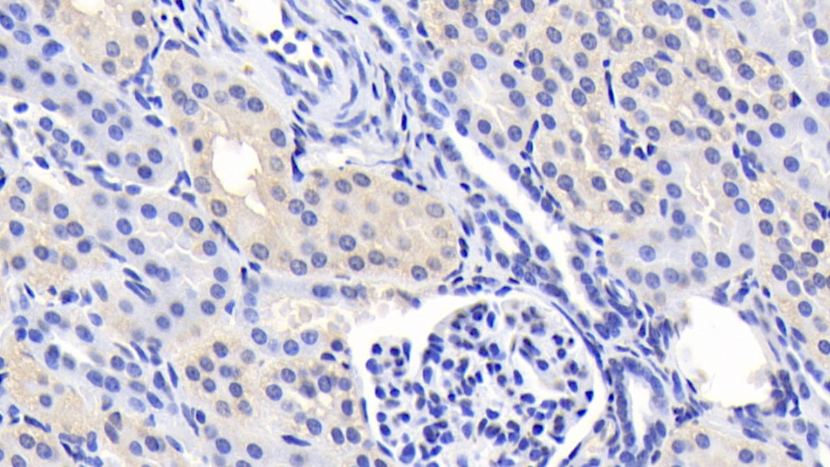 Monoclonal Antibody to Phenylalanine Hydroxylase (PAH)