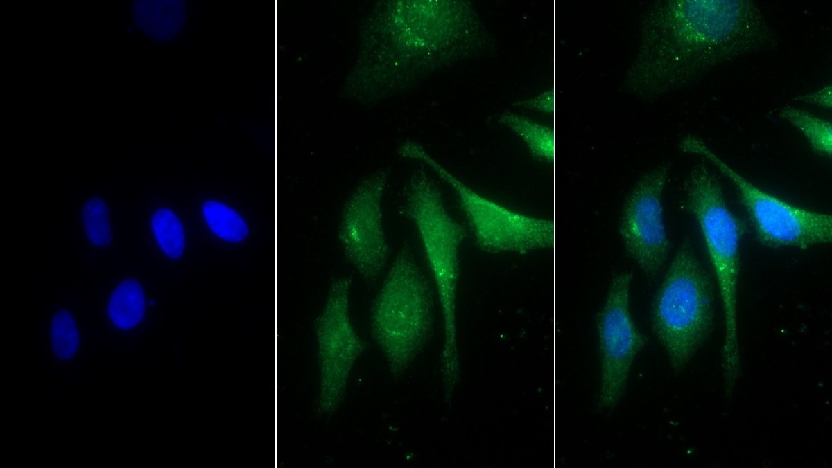 Monoclonal Antibody to Prosaposin (PSAP)