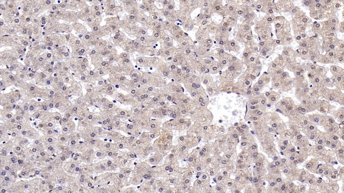 Monoclonal Antibody to Reelin (RELN)