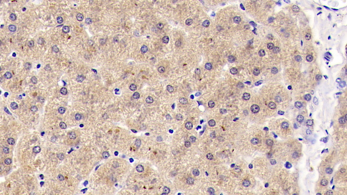 Monoclonal Antibody to Reelin (RELN)