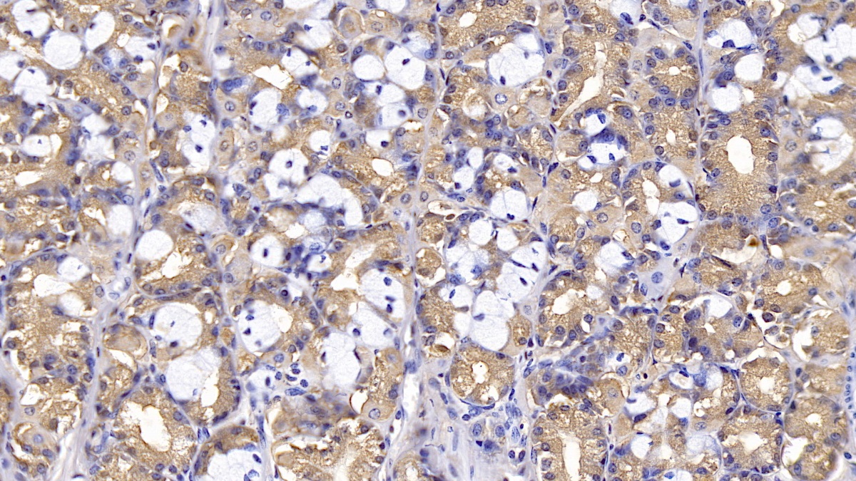 Monoclonal Antibody to Thymidine Kinase 1, Soluble (TK1)