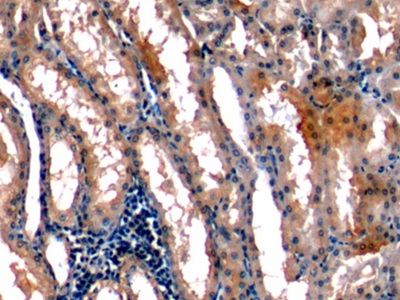 Monoclonal Antibody to Stanniocalcin 1 (STC1)