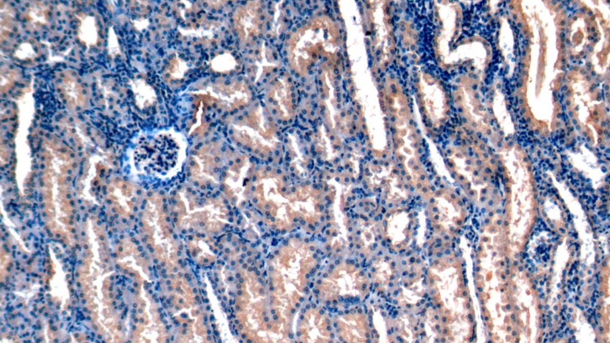 Monoclonal Antibody to Stanniocalcin 1 (STC1)