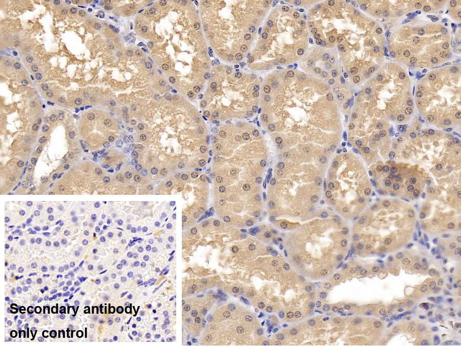 Monoclonal Antibody to Stanniocalcin 1 (STC1)