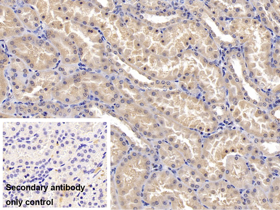 Monoclonal Antibody to Stanniocalcin 1 (STC1)