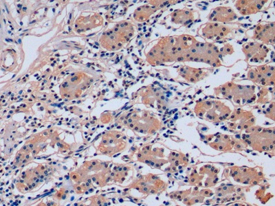 Monoclonal Antibody to Fibroblast Growth Factor 21 (FGF21)