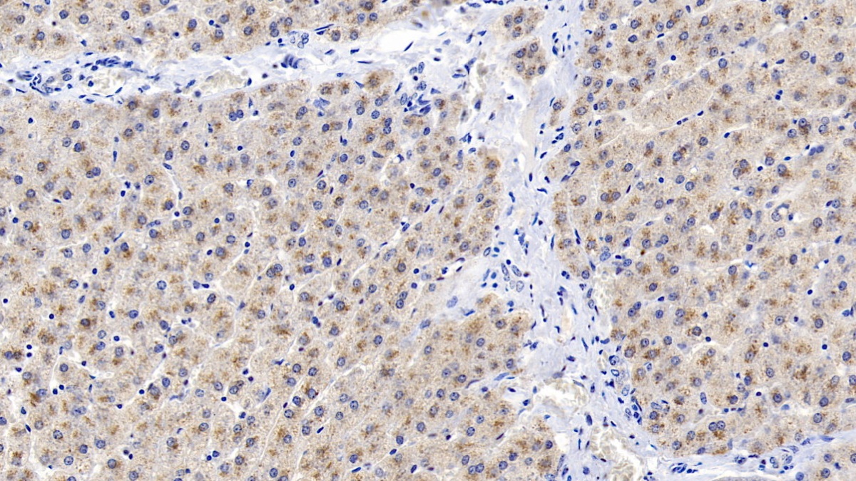 Monoclonal Antibody to Carcinoembryonic Antigen Related Cell Adhesion Molecule 1 (CEACAM1)