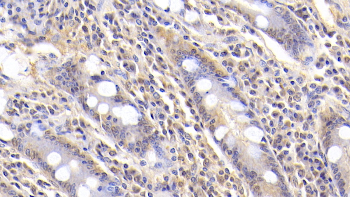 Monoclonal Antibody to Arginyl tRNA Synthetase (RARS)