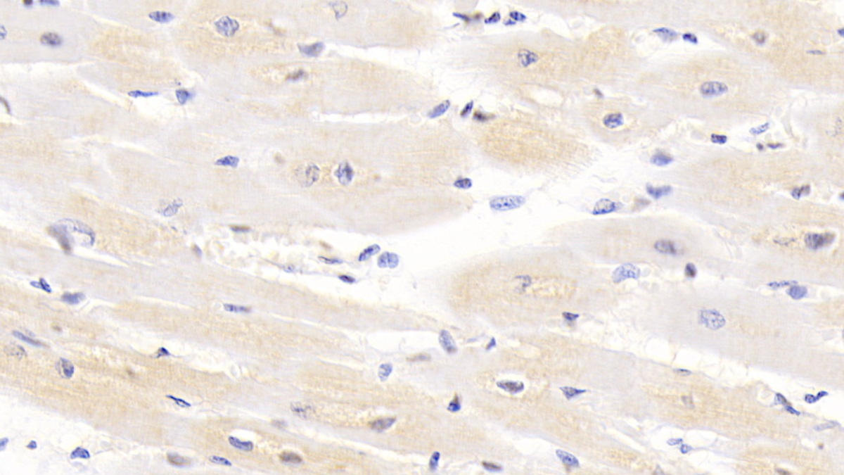 Monoclonal Antibody to Arginyl tRNA Synthetase (RARS)