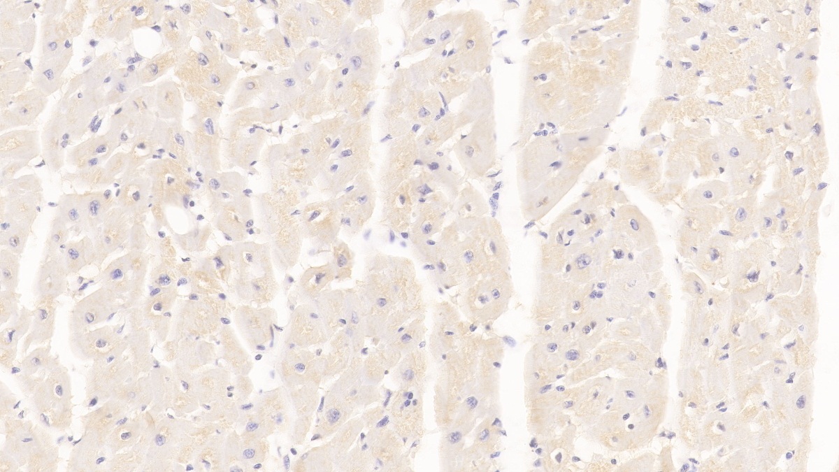 Monoclonal Antibody to Arginyl tRNA Synthetase (RARS)