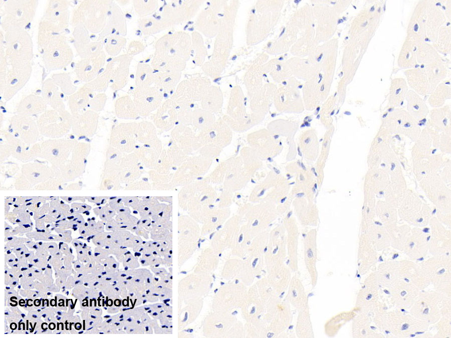 Monoclonal Antibody to Arginyl tRNA Synthetase (RARS)