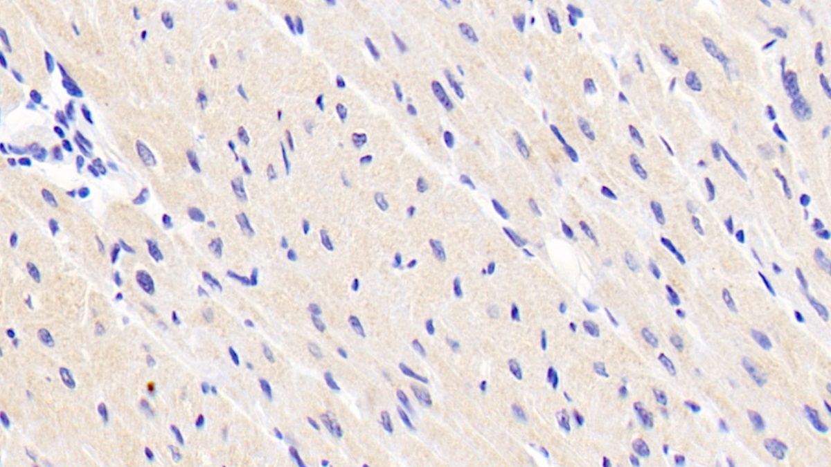 Monoclonal Antibody to Arginyl tRNA Synthetase (RARS)