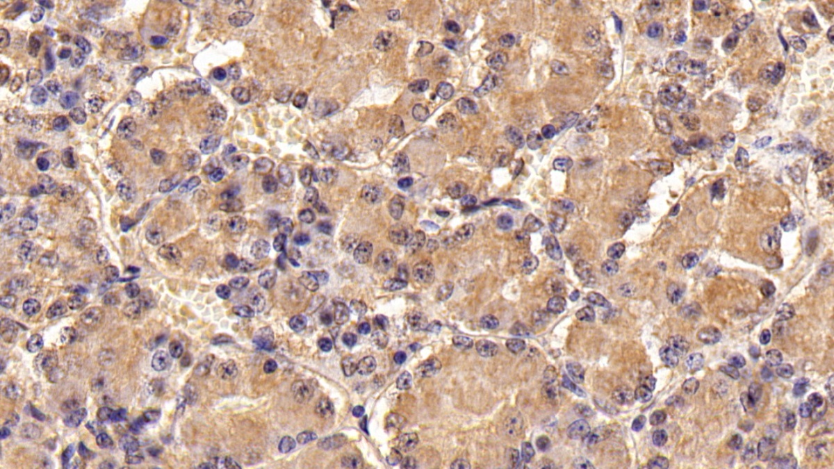 Monoclonal Antibody to Follicle Stimulating Hormone Beta (FSHb)