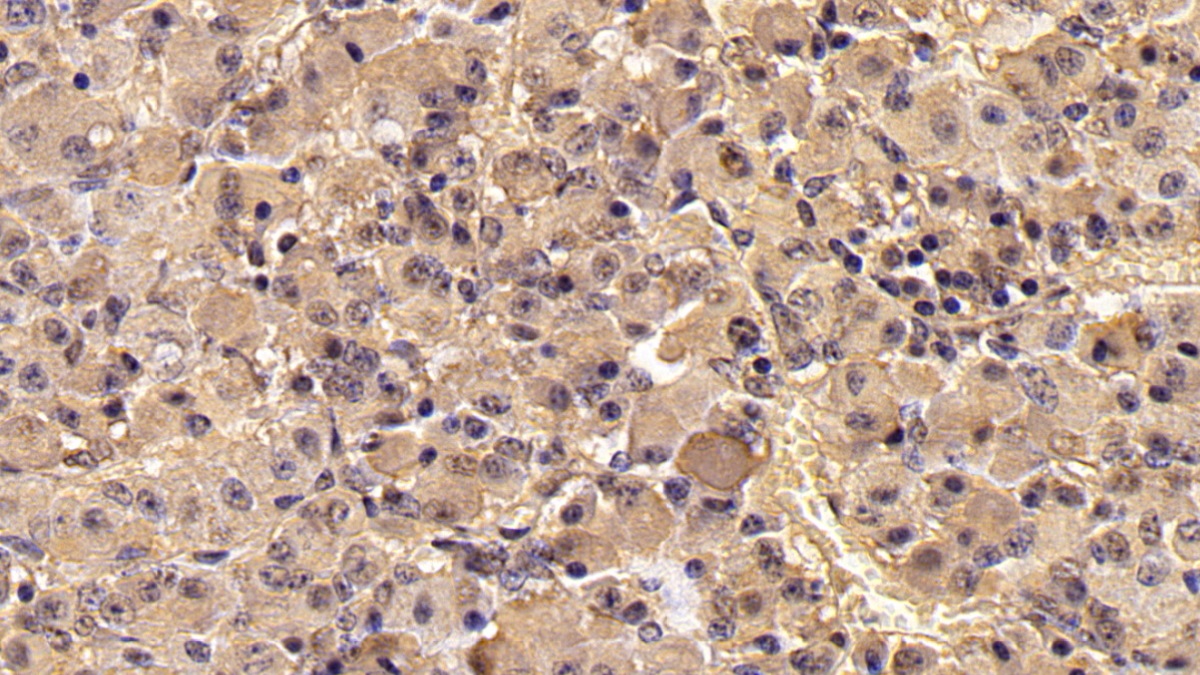 Monoclonal Antibody to Follicle Stimulating Hormone Beta (FSHb)