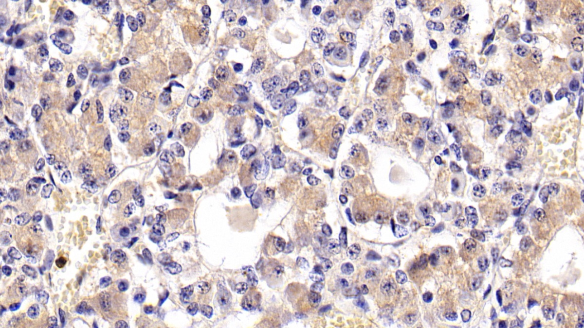 Monoclonal Antibody to Follicle Stimulating Hormone Beta (FSHb)