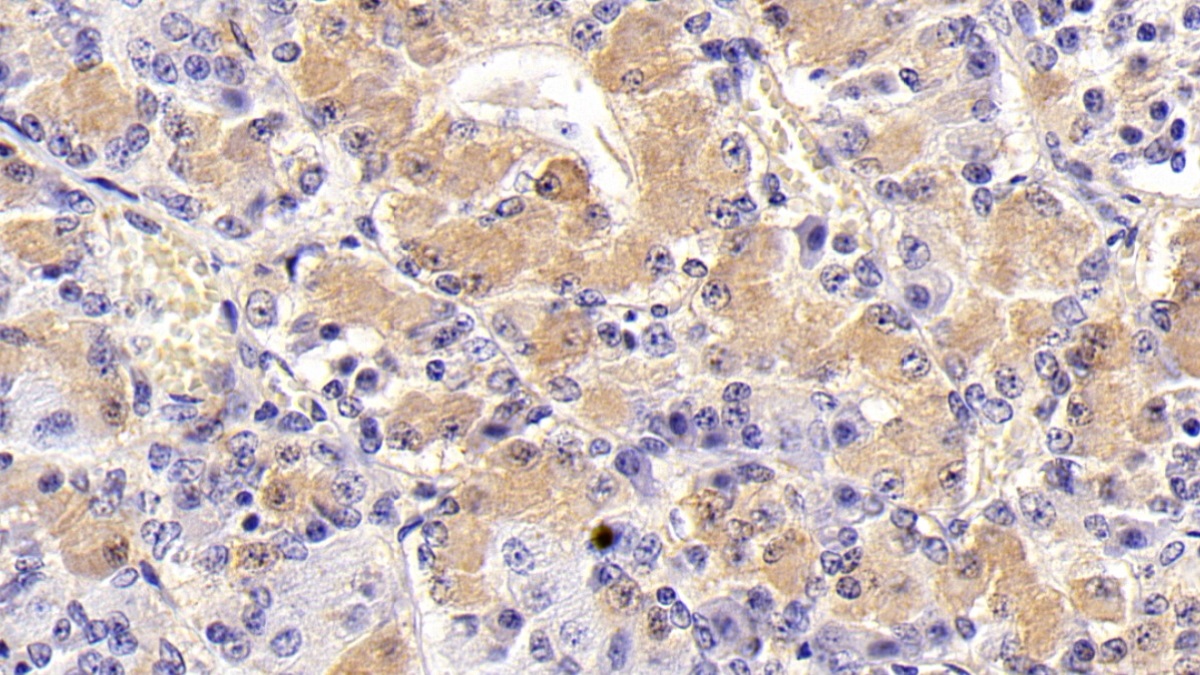 Monoclonal Antibody to Follicle Stimulating Hormone Beta (FSHb)