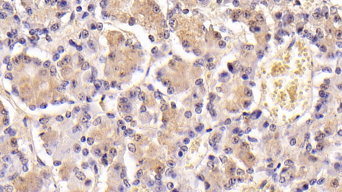 Monoclonal Antibody to Follicle Stimulating Hormone Beta (FSHb)