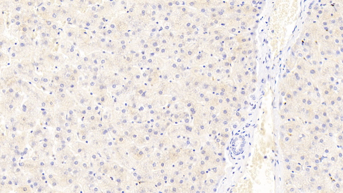 Monoclonal Antibody to Ferritin, Light Polypeptide (FTL)