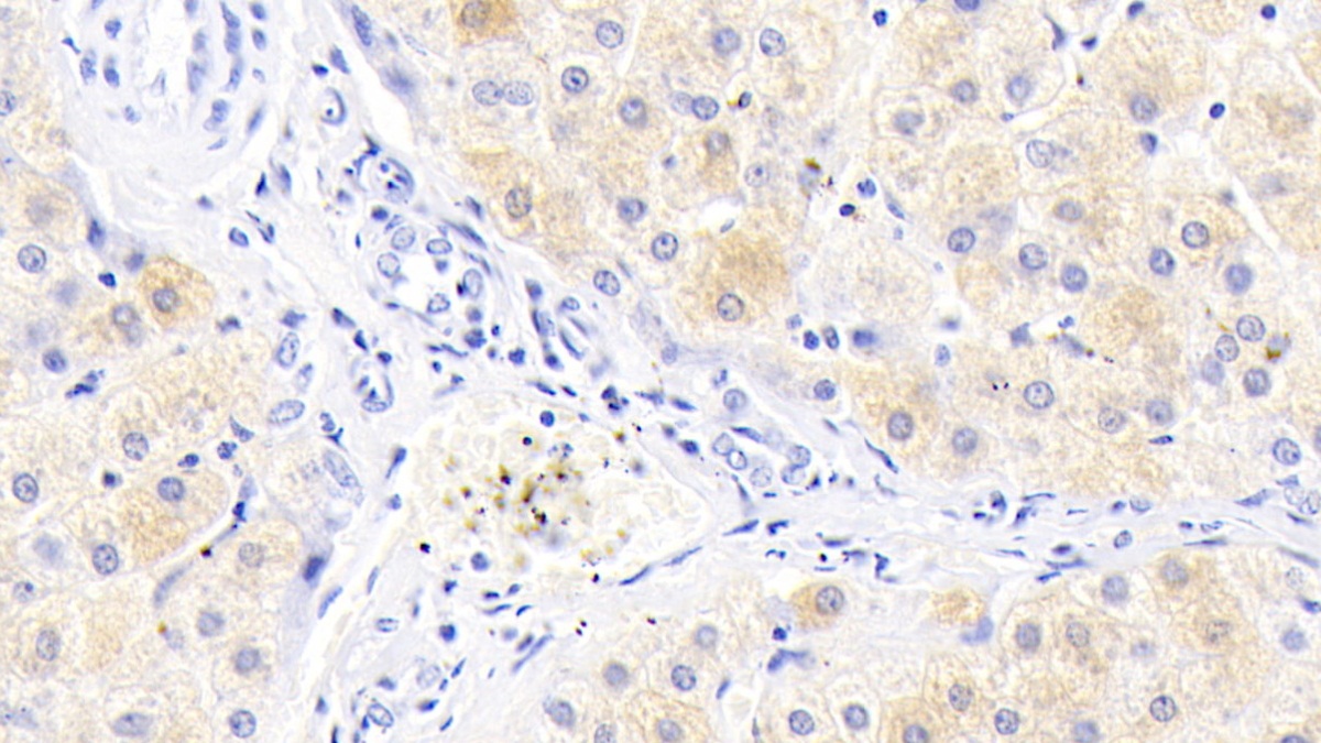 Monoclonal Antibody to Ferritin, Light Polypeptide (FTL)