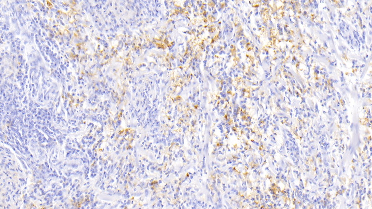 Monoclonal Antibody to Ferritin, Light Polypeptide (FTL)