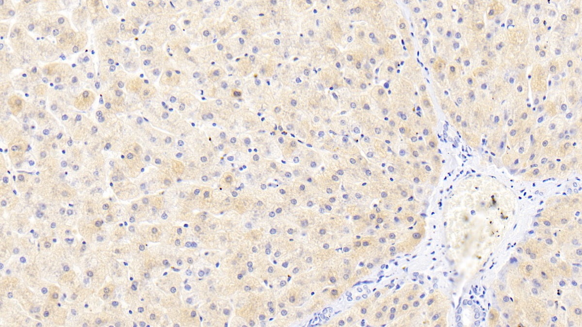 Monoclonal Antibody to Ferritin, Light Polypeptide (FTL)