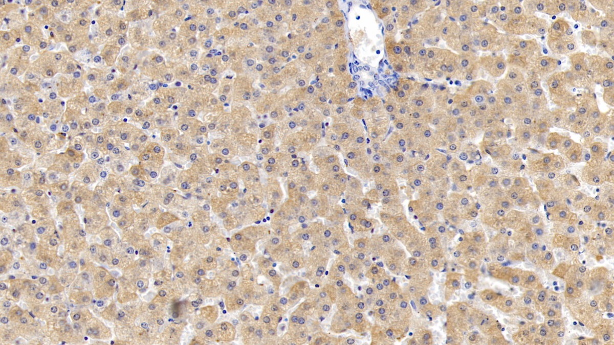 Monoclonal Antibody to Ferritin, Heavy Polypeptide (FTH)