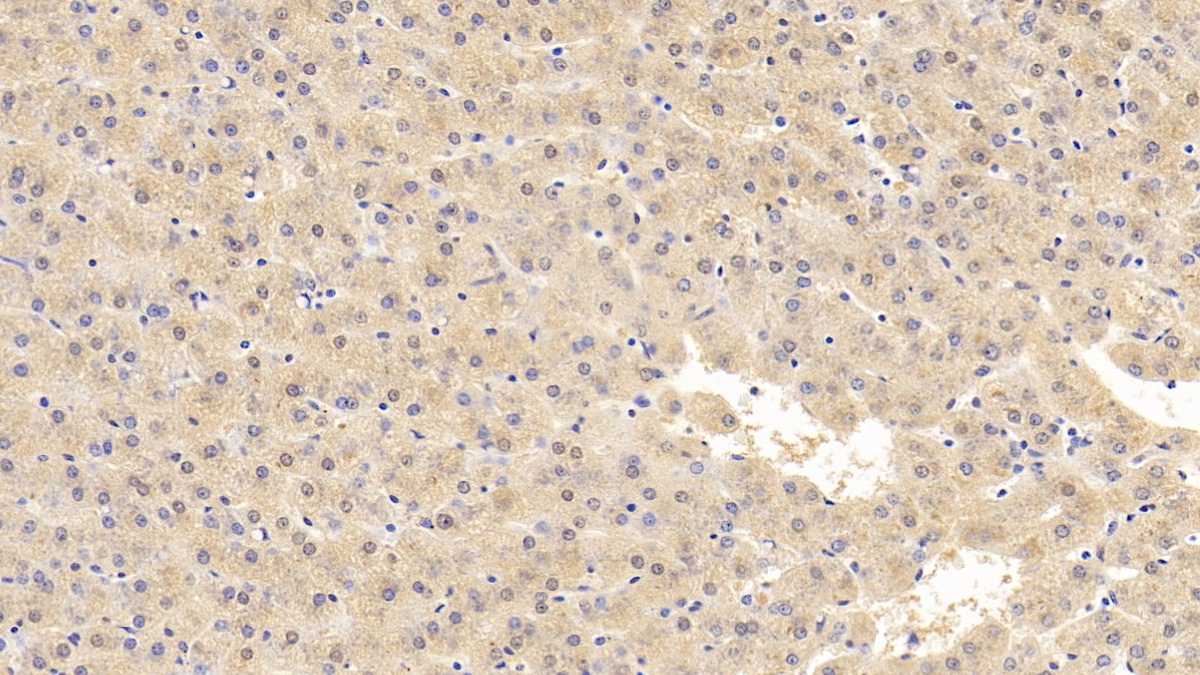 Monoclonal Antibody to Ferritin, Heavy Polypeptide (FTH)