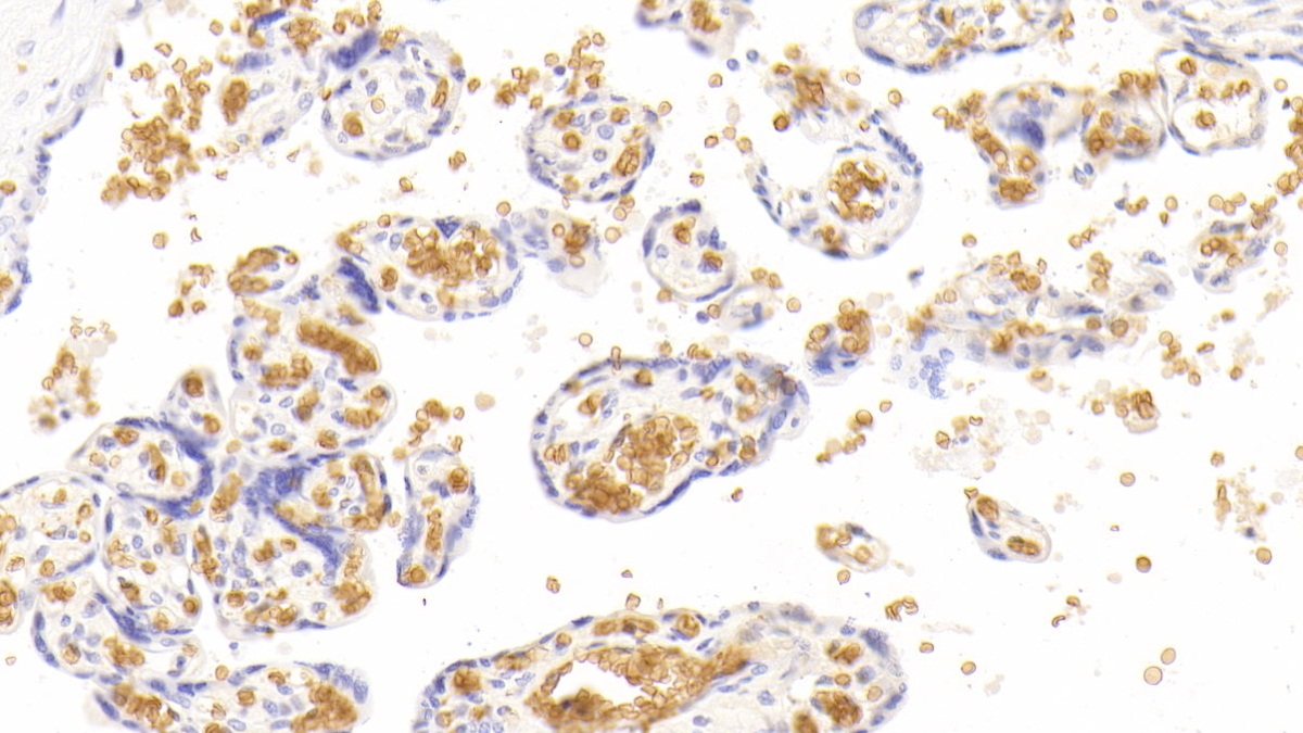 Monoclonal Antibody to Hemoglobin Alpha 1 (HBa1)