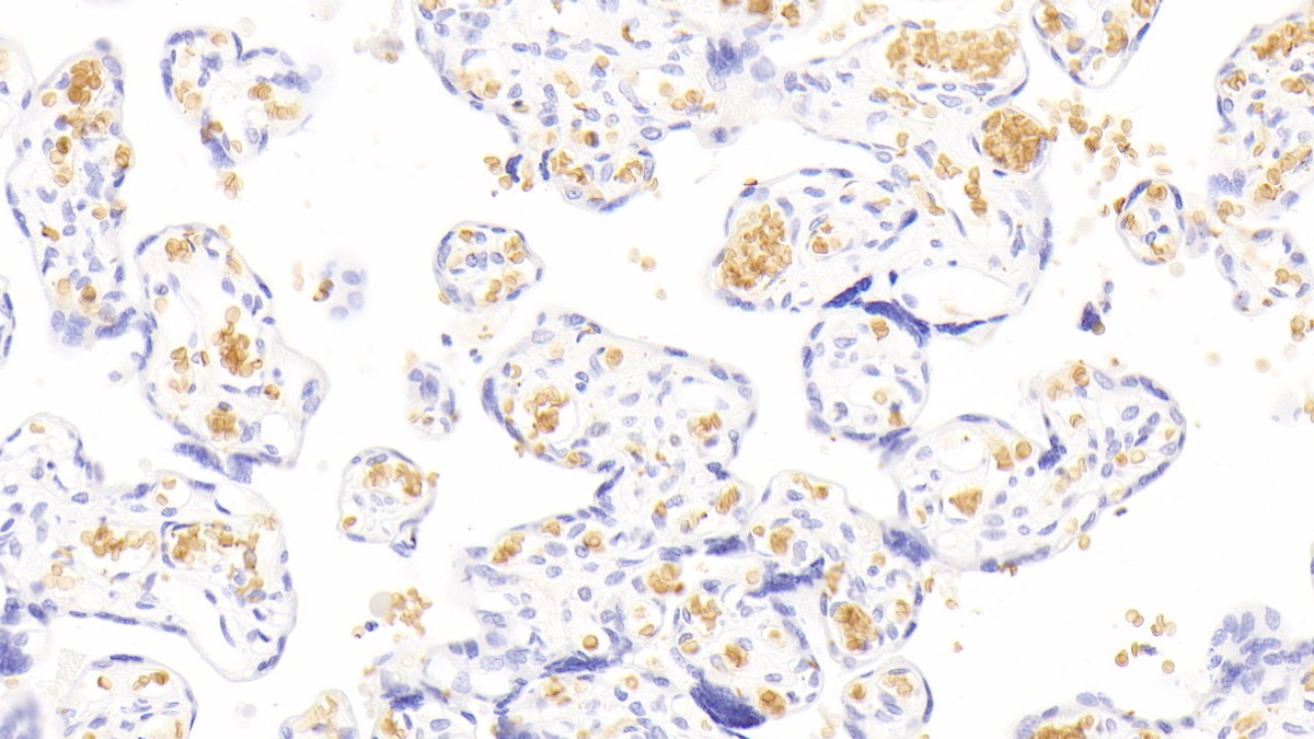 Monoclonal Antibody to Hemoglobin Alpha 1 (HBa1)