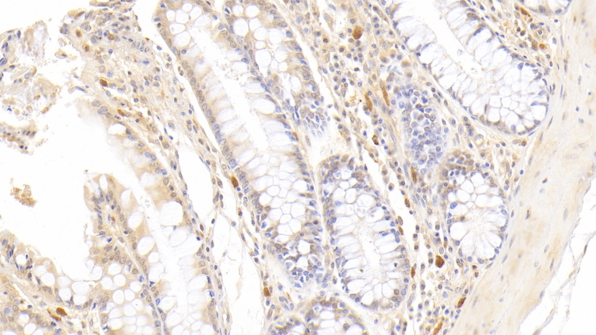 Monoclonal Antibody to Ribonuclease A2 (RNASE2)