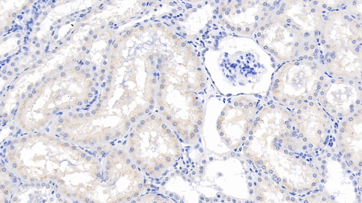 Monoclonal Antibody to Ribonuclease A2 (RNASE2)