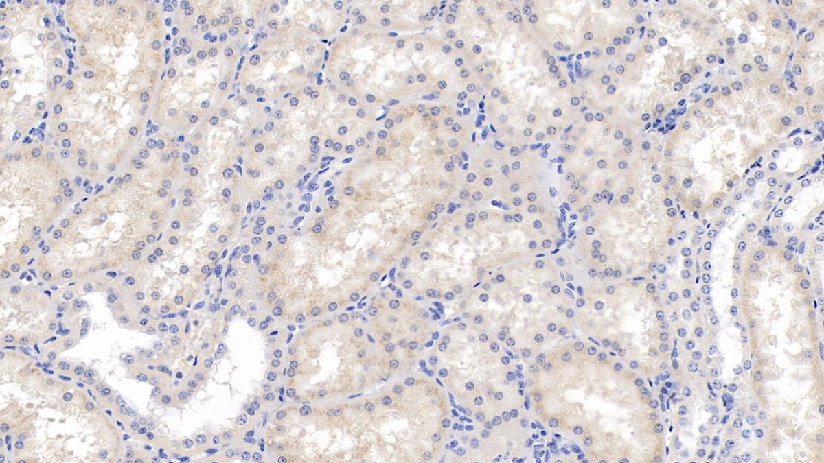 Monoclonal Antibody to Ribonuclease A2 (RNASE2)