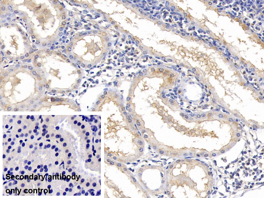 Monoclonal Antibody to Ribonuclease A2 (RNASE2)